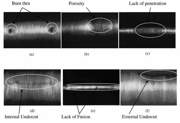 RADIOGRAPHY EXAMINATION RT